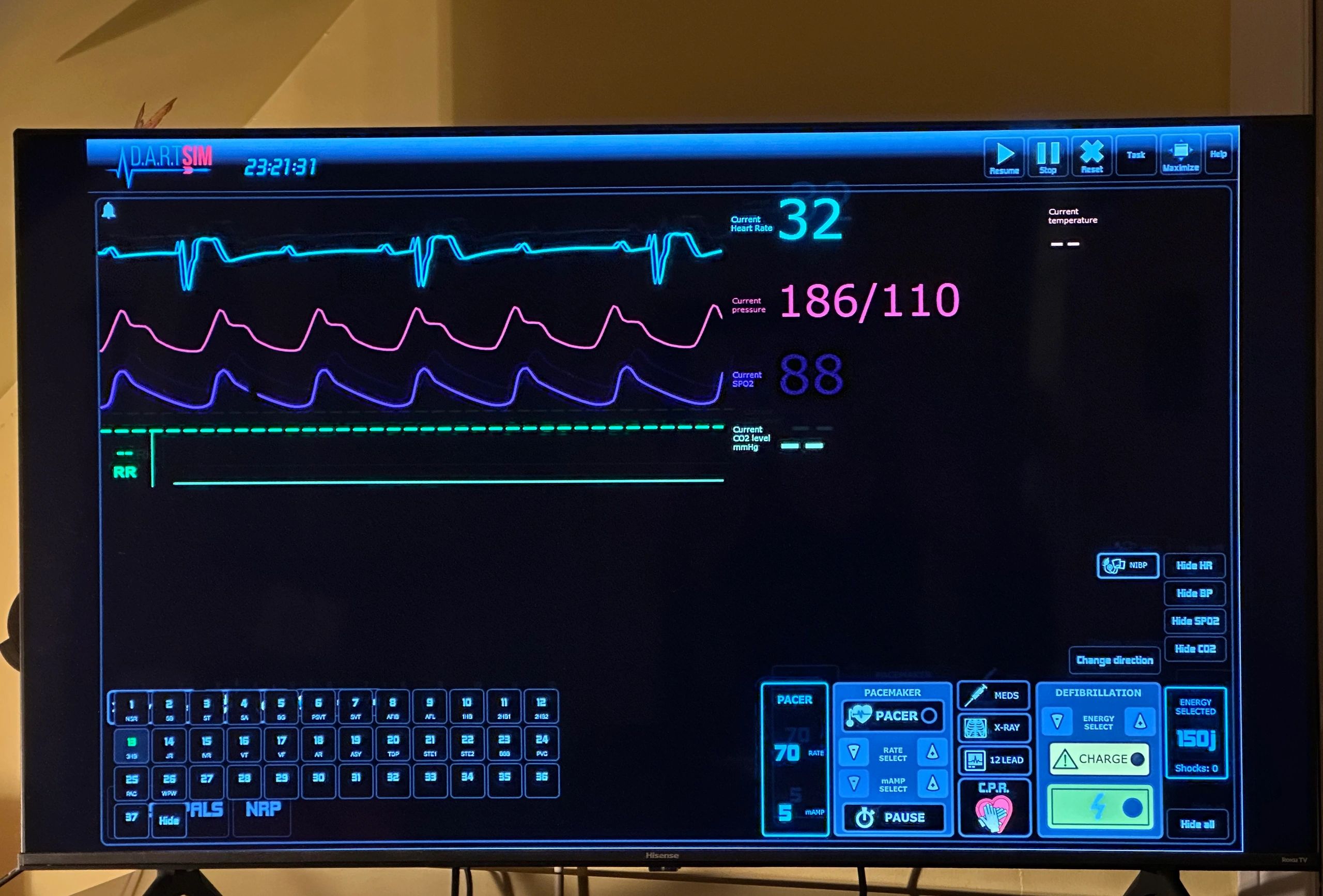Medical simulation vital signs monitor